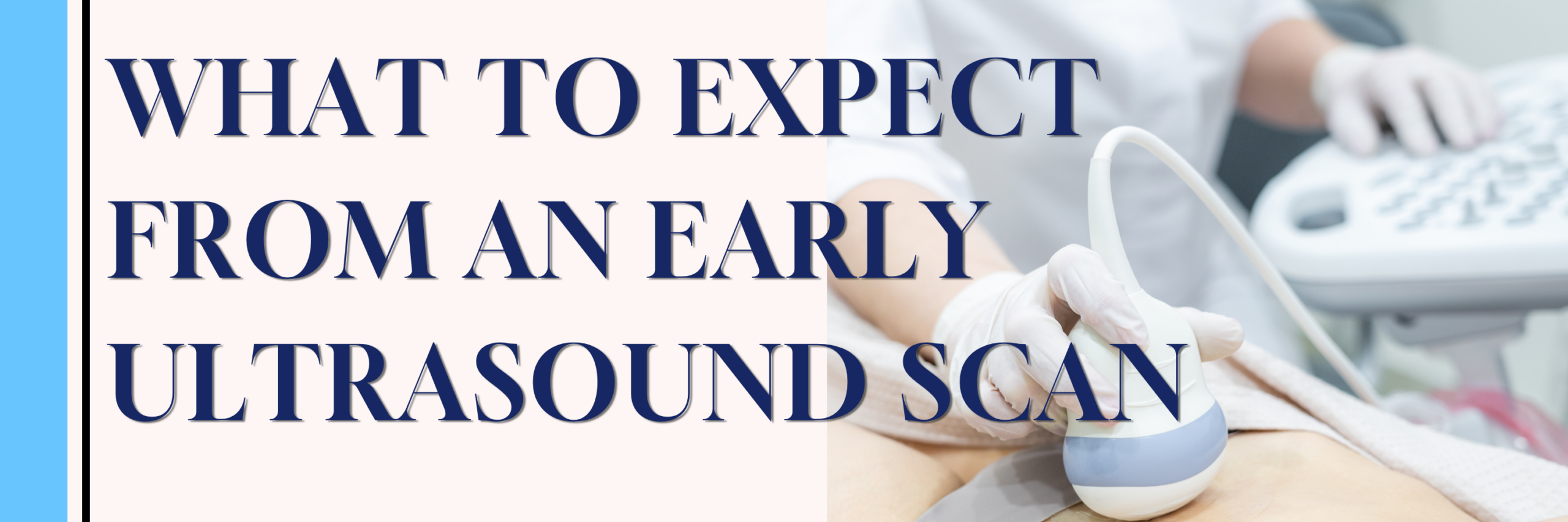 WHAT TO EXPECT FROM AN EARLY ULTRASOUND SCAN